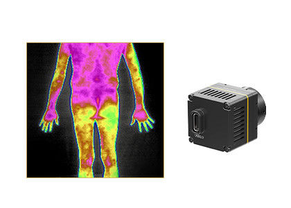 Câmeras infravermelhas térmicas da imagem latente para soluções médicas do Thermography