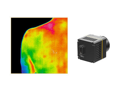 núcleo infravermelho da câmera de 384x288 17um para o Thermography médico
